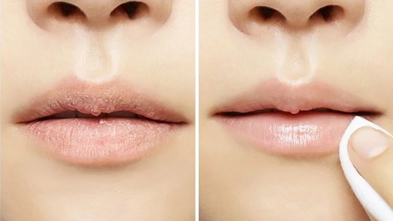 Tẩy tế bào chết cho môi