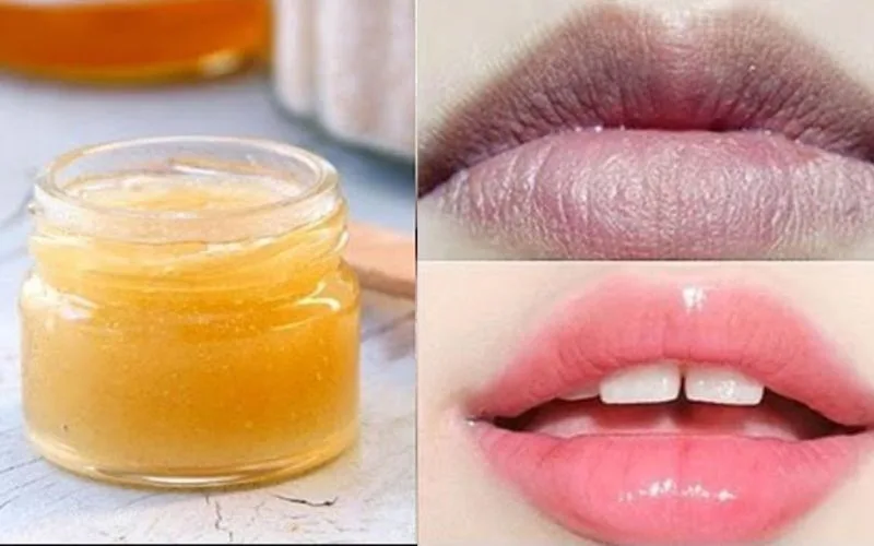 8 cách khử thâm môi tại nhà đơn giản mà lại hiệu quả