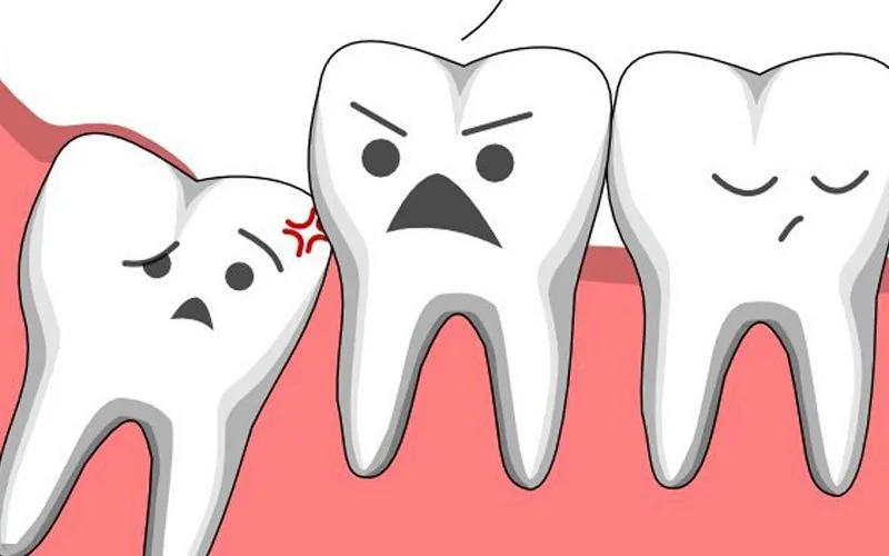 Những câu nói hài hước về răng khiến ta cười rung chem chép