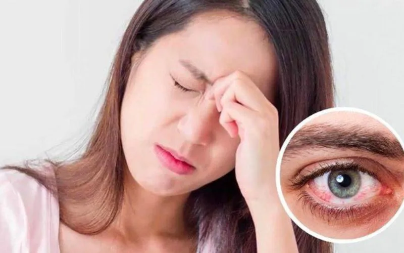 Bị đau mắt có ăn được thịt gà không? ăn gì thì tốt nhất?