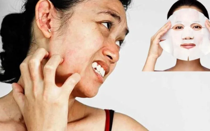 Đắp mặt nạ bị rát có sao không? các tiêu chí chọn mặt nạ phù hợp?