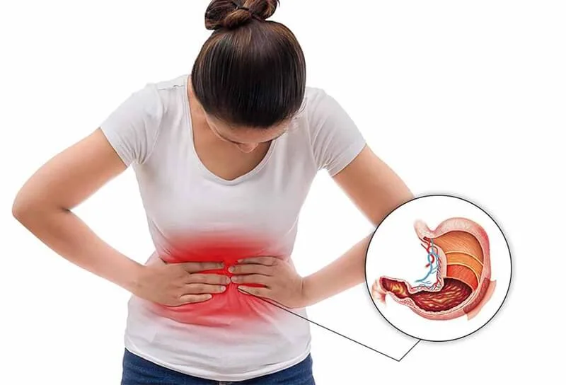 Những cách trị nóng bụng khi ăn cay tại nhà hiệu quả, an toàn