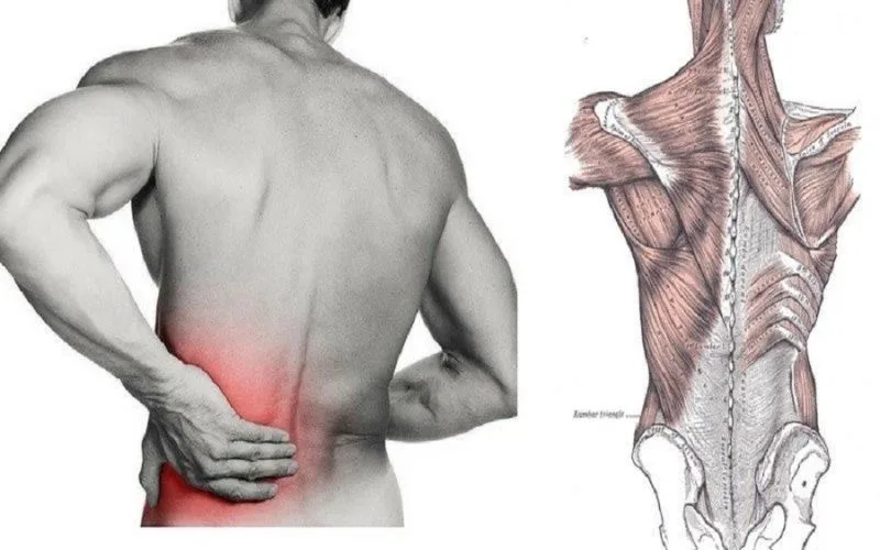 Căng cơ lưng bao lâu thì khỏi? cách điều trị ngay tại nhà hiệu quả